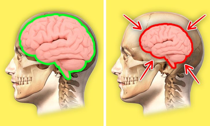 creier sanatos versus creier inflamat desen grafic